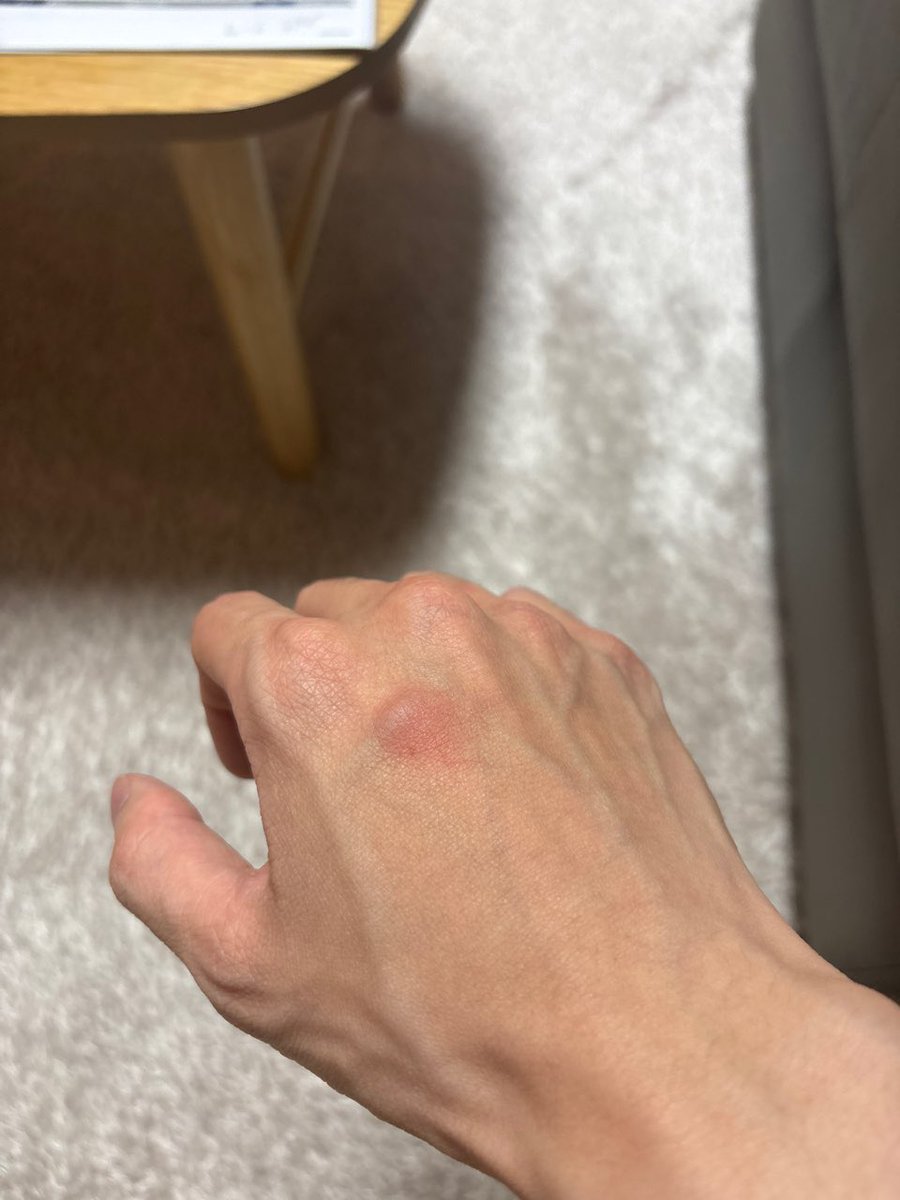 HENDERY 💭

“??????????????”
“Mosquito, come out! I promise I’ll give you a warm round of applause”