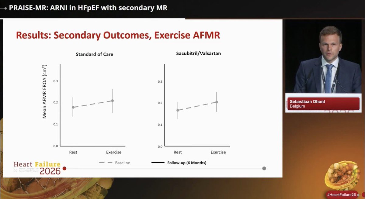 slumberbell's tweet photo. 🫀PRAISE-MR: sacubitril/valsartan in #HFpEF with atrial functional mitral regurgitation #AFMR?
Presented by @S_Dhont at #HeartFailure26:
📍#SacVal improved exercise-induced #PH, ⬇️ mPAP/CO slope vs standard care
📍#ARNI therapy promoted reverse remodeling and blunted the dynamic increase in MR during exercise
📍Improvements were also seen in KCCQ, peak VO₂, NT-proBNP, LV-GLS & LAVI
@escardio @WilfriedMullens @MarcoMetra @jozinetm @HFA_President