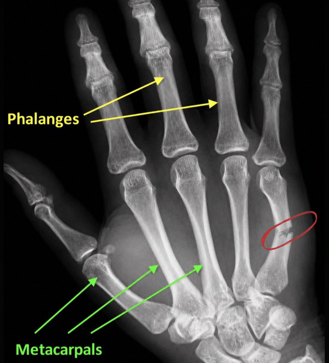 THE B🥊XING PHYSIO (allabouttheupperlimb🖐️🤛💪) tweet media