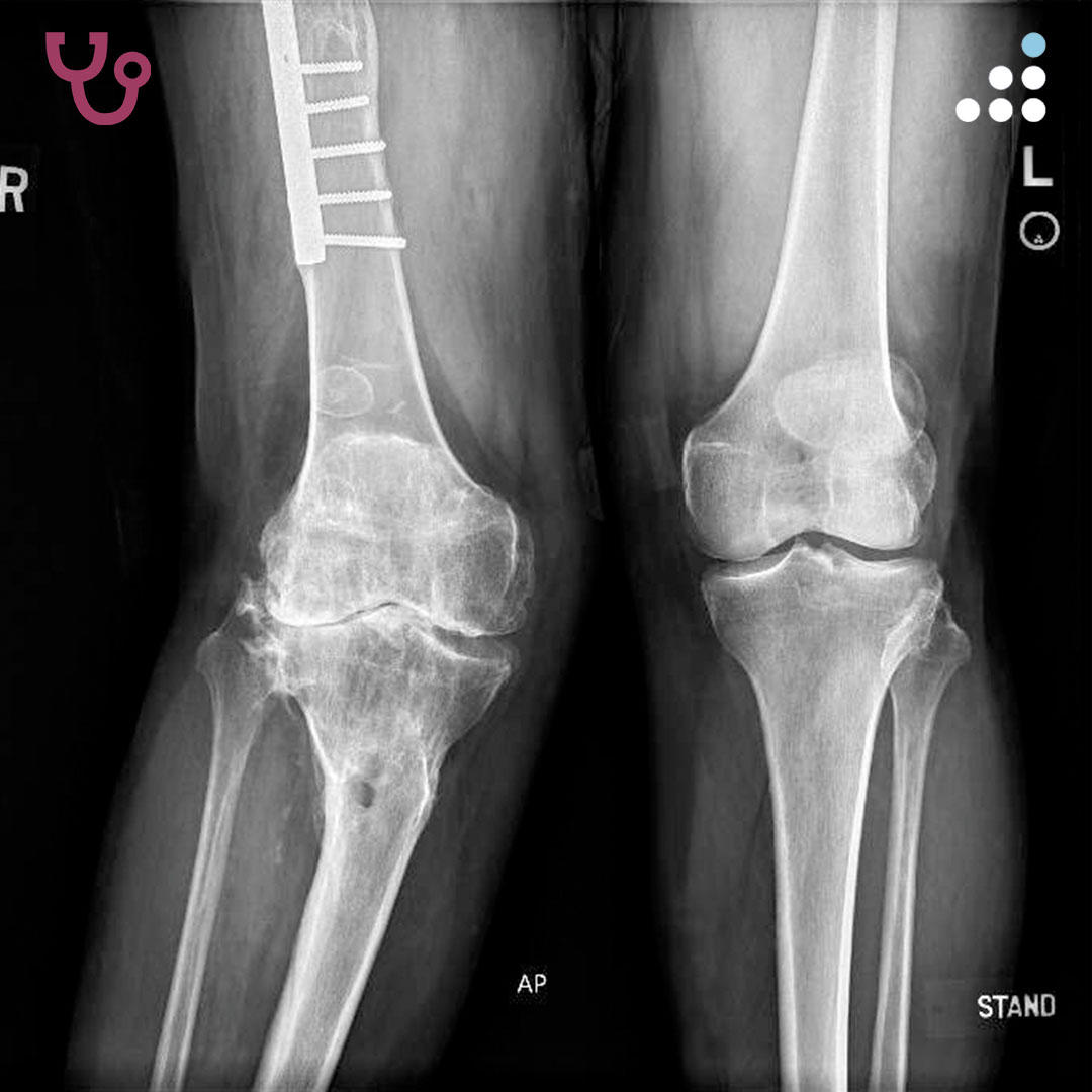 Orthobullets tweet media