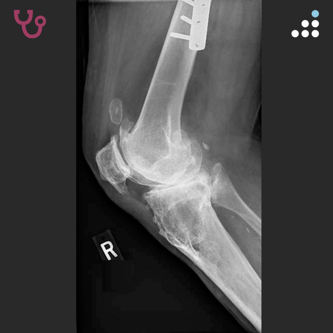 Orthobullets tweet media