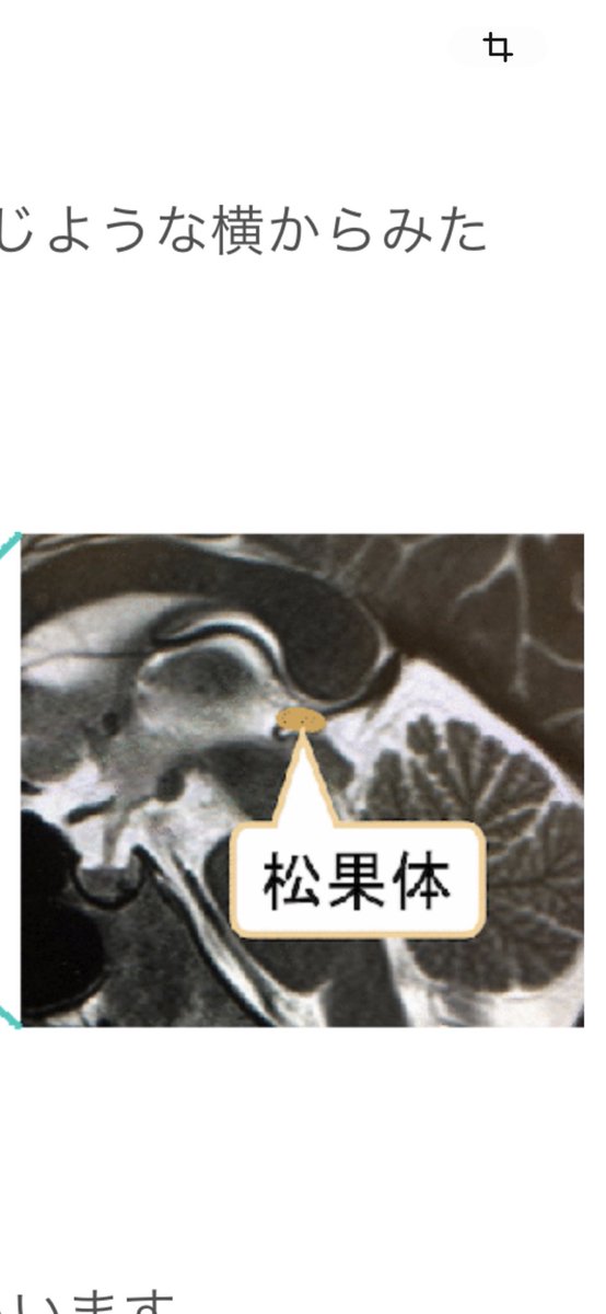 光源氏にはアヌンナキ遺伝子が組み込まれていますので、エジプトのホルスの眼の役割の意味合いが分かります。人間の脳の松果体の直ぐ左側に、ホルスの眼があります。
つまり、これが第三の目になります。MRIやCTで撮影すれば、分かります。