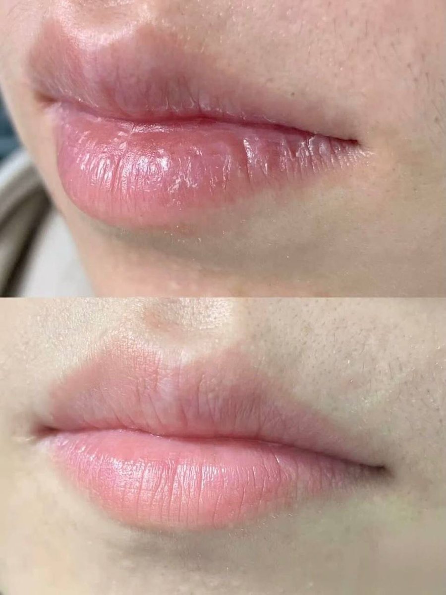 lounoiree's tweet photo. Yang ini di pake biar bibir kita tetep lembab, bikin bibir kelihatan lebih pinky &amp; sehat 
🛒 https://t.co/lHY6TW8T5j

Kalau bibir kalian pecah-pecah &amp; kering healbalm solusi nya, di pake malam hari yaa 
🛒 https://t.co/lvjZBewuML https://t.co/UPZQKIq0r6