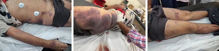 Jaswinder Singh, a 35-year-old BSF soldier was examined for the last time around 12.15 pm on 18 March, according to that day’s medical report. “Accused is physically fit after clinical examination in my opinion,” the doctor wrote, after checking his blood pressure, pulse and