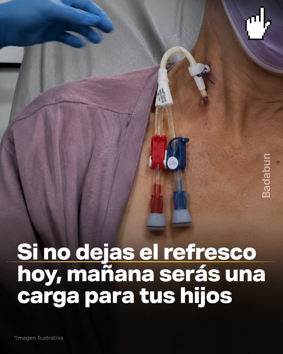 👉👉 Hoy te tomas un refresco y no pasa nada. Mañana otro. El fin de semana dos. Y así, durante 20 años. Lo que no te dicen es que ese refresco no te va a matar — te va a dejar vivo, pero conectado a una máquina 4 horas, 3 veces a la semana, dependiendo de tu hija para que te