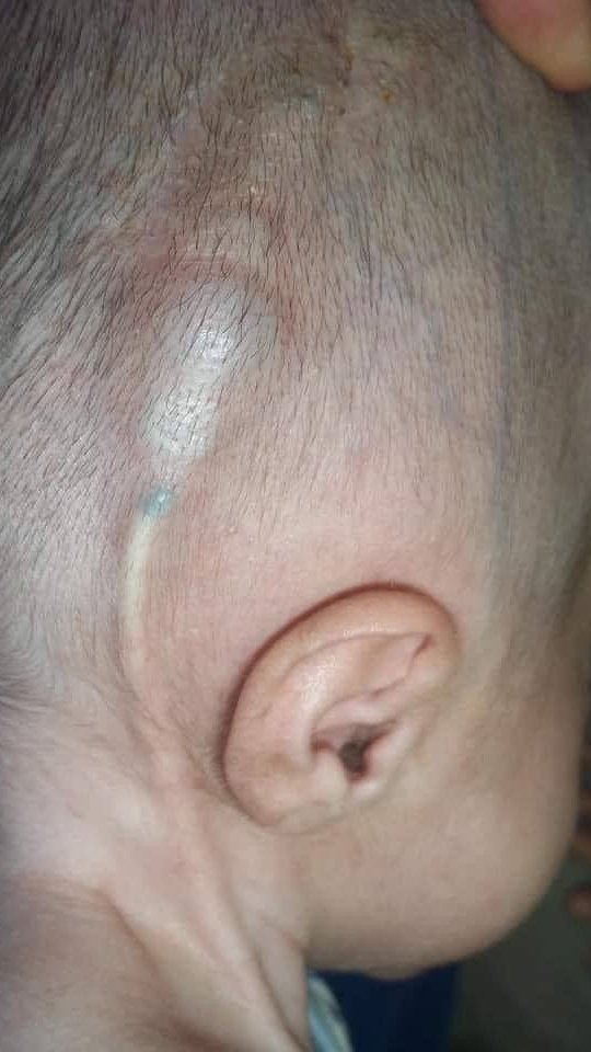 IhabFathiSulima's tweet photo. What is the description or diagnosis? https://t.co/LBPeRSg34C