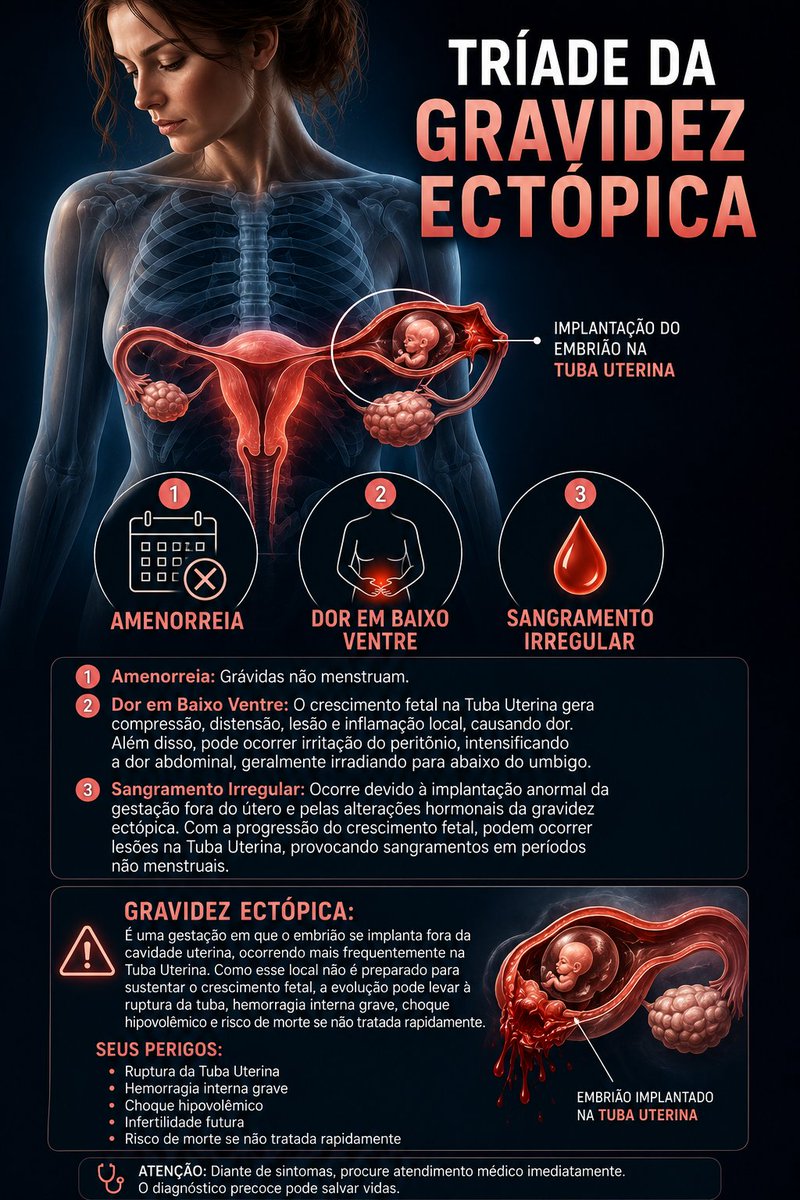 malucobeleza06's tweet photo. Se você gosta de conteúdos sobre saúde, bem-estar, curiosidades médicas e informações importantes sobre o corpo humano, me acompanhe por aqui.

Sou estudante de medicina e estou criando conteúdos com o objetivo de tornar o conhecimento em saúde mais simples, acessível e útil para todos. Quero ajudar pessoas a entenderem melhor doenças, prevenção, qualidade de vida e até temas que muitas vezes não são explicados de forma clara.

Se esse tipo de conteúdo te ajuda de alguma forma, peço de coração: siga meu perfil, curta, compartilhe e interaja com as postagens. Isso me ajuda muito no engajamento e me permite continuar criando cada vez mais conteúdos educativos e de qualidade.

Seu apoio pode fazer esse projeto alcançar muito mais pessoas. Obrigado por fazer parte disso.

Referências Utilizadas para criar a imagem e estudar sobre o assunto:

SANARMED

SANARMED. Resumo sobre gravidez ectópica. Salvador: Sanar, 2020. Disponível em: SANARMED – Resumo sobre gravidez ectópica. Acesso em: 9 maio 2026.
MEDWAY

MEDWAY. Gravidez ectópica e suas particularidades. [S. l.]: Medway, [s. d.]. Disponível em: Medway – Gravidez ectópica e suas particularidades. Acesso em: 9 maio 2026.

Links:
SanarMED: 
https://t.co/apl6rFbZdy
Medway: https://t.co/mb6bHiufdF