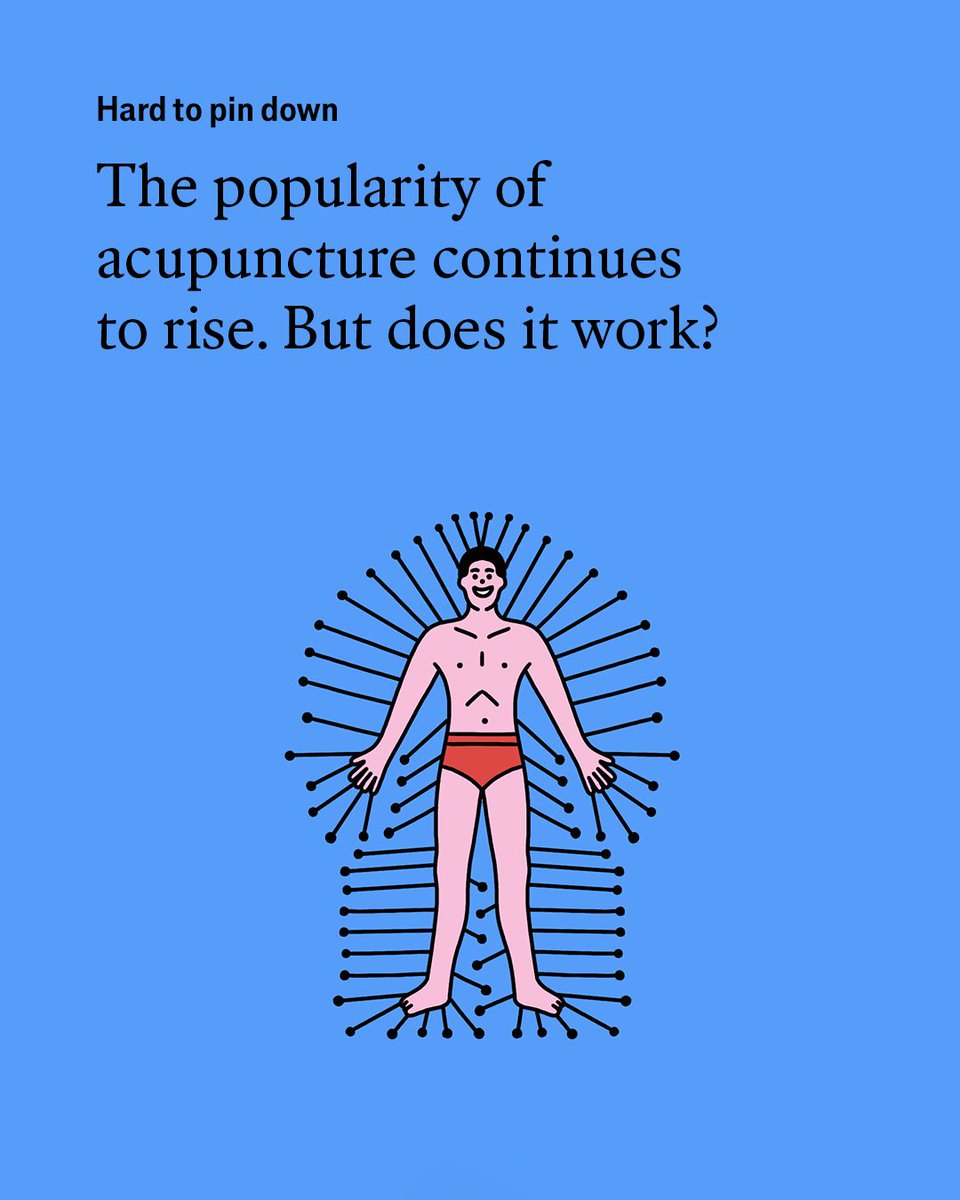 acupuncture = 鍼治療