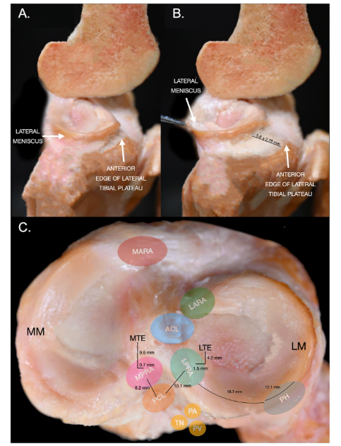 jbjs's tweet photo. "Evaluation and Management of Meniscal Tears" by Morgan et al.

Read the full article 👉 https://t.co/bxwaQn5Q3X

#JBJS https://t.co/d5KbIUiB2H