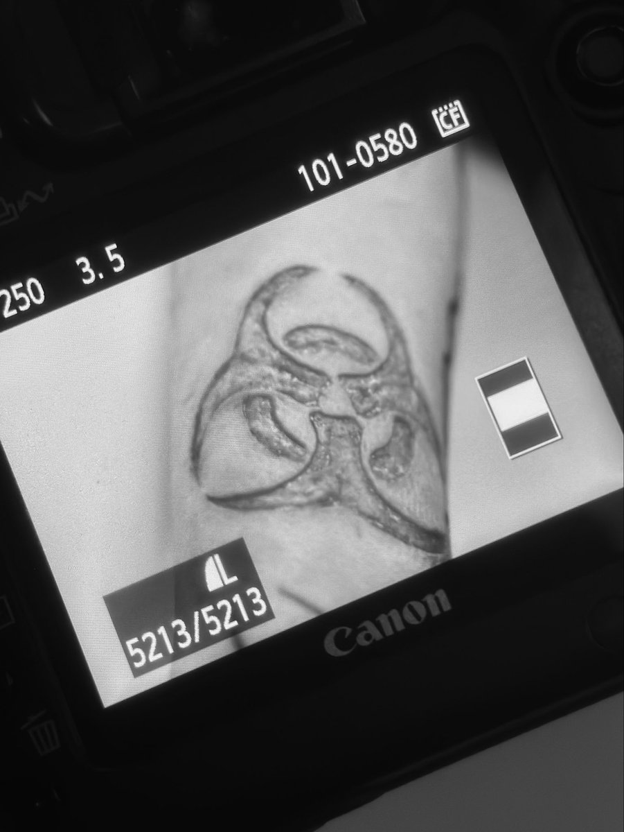 pvncture_ritual's tweet photo. The return of the biohazard scar ☣️🖤 https://t.co/L2Dkf7wlcg