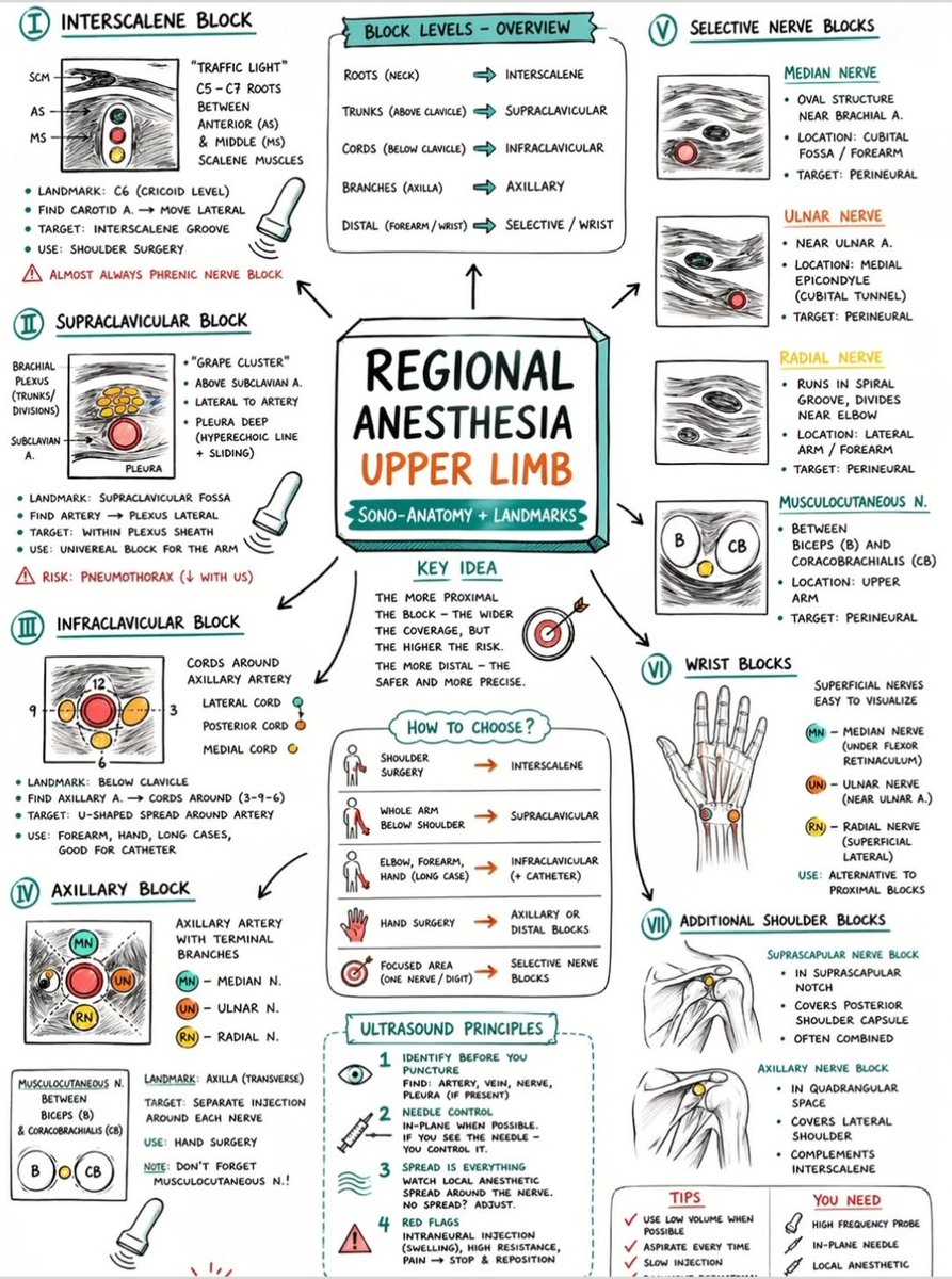 drsthanus's tweet photo. This infographic outlines seven distinct regional anesthesia techniques for the upper limb, categorized by the level of the brachial plexus being targeted.

https://t.co/DjjG3BHwYF https://t.co/Ifr67uVLrg