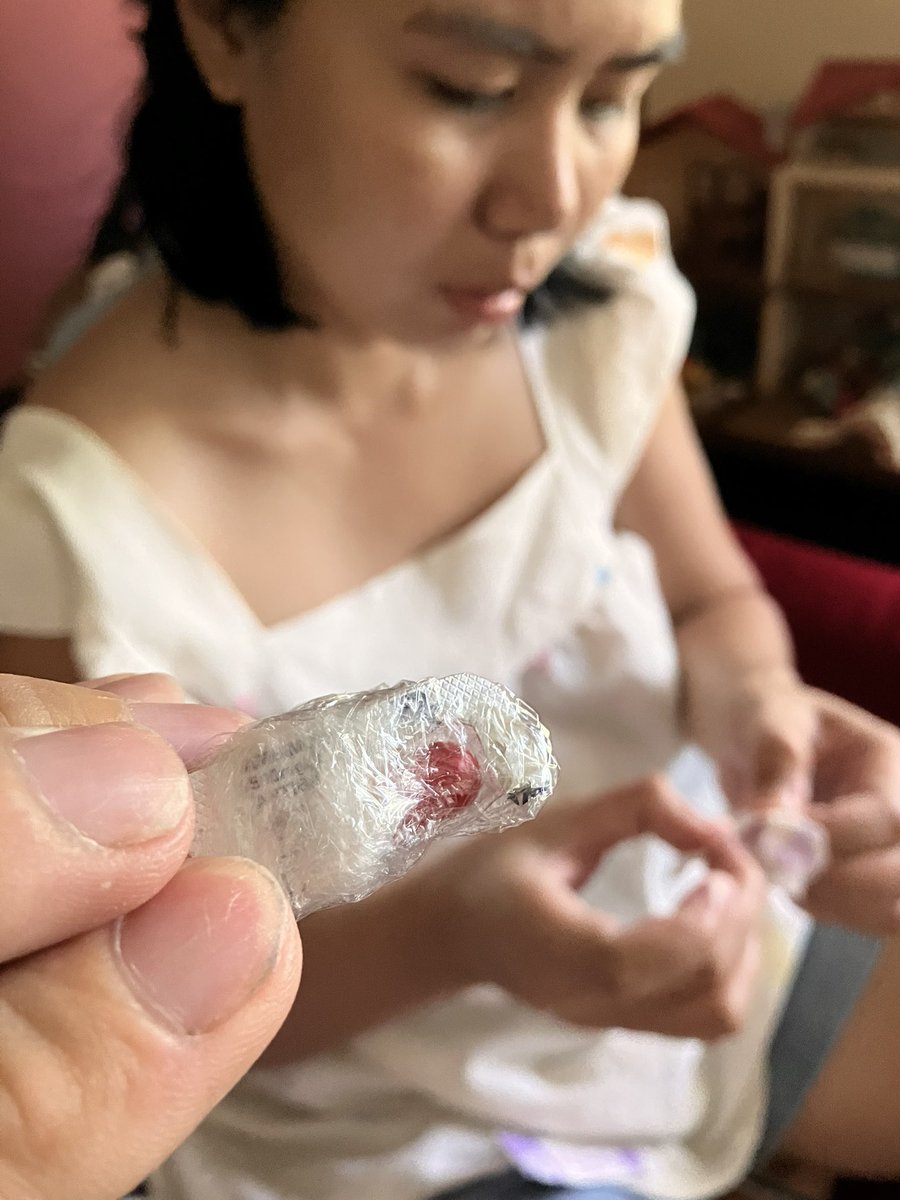 Kuya_Kaz's tweet photo. フィリピン妻の指が何かに感染。

腫れあがったので針で中の膿を取って
抗生物質のアモキシシリンを患部にふりかけ絆創膏をする。

なんて逞しい現地人🥹

病院いったら処方箋出されて高い診察料とのこと😂

ちなみにこの抗生物質は処方箋いるけどローカルで普通に買えるフィリピンあるある😅😂笑 https://t.co/Ju4OO3dPOm