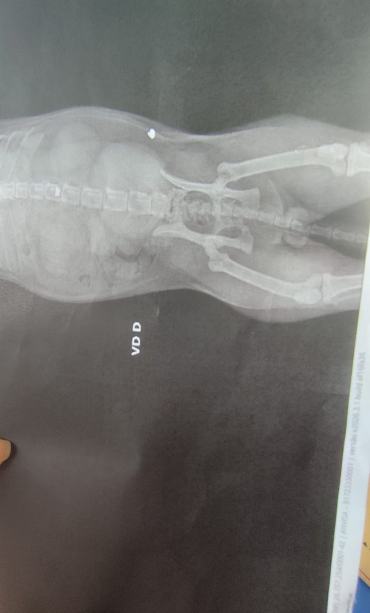 No hospital para ele fazer uma cirurgia. Os médicos conseguiram tirar o projétil no abdômen dele, mas na coluna ficou pois eles não tinham condições de tirá-lo porque tinha risco de paralisar o corpo dele inteiro. Então voltamos para casa e continuamos indo até o hospital(+)