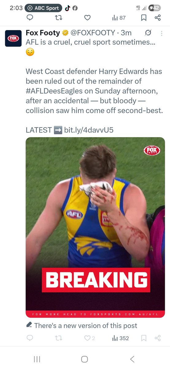 PeoplesAlert1's tweet photo. @AFLisnotasport it seems like someone at Fox Footy is paying attention... 😀 https://t.co/lznSkhQFZd