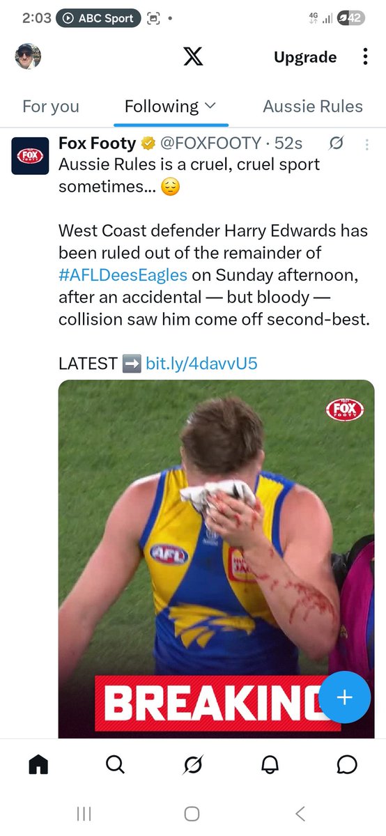PeoplesAlert1's tweet photo. @AFLisnotasport it seems like someone at Fox Footy is paying attention... 😀 https://t.co/lznSkhQFZd