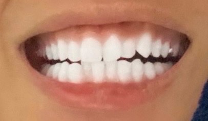 君達を使い始めて、最近歯しか褒められてないwwwwww