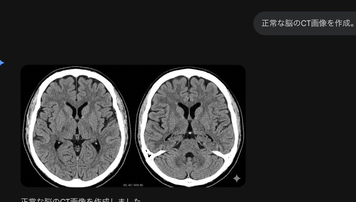 attheben's tweet photo. 周りが白いのはCTっぽい気もするけど実質がMRIっぽい https://t.co/wTIvfZgbWR