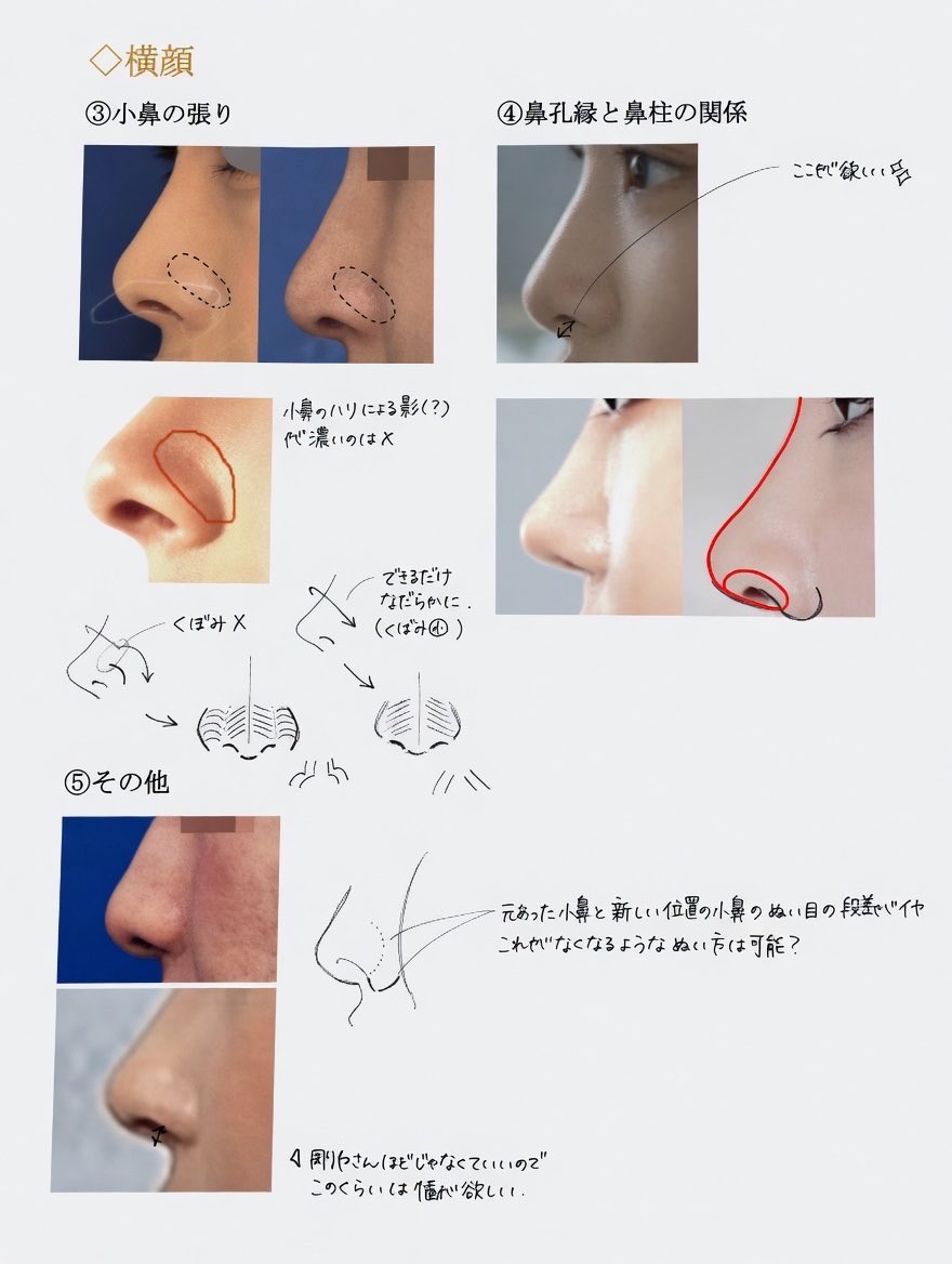鼻整形の良医選び🏥鼻尖形成、鼻中隔延長、鼻フル、プロテーゼ、鼻翼縮小、小鼻縮小、貴族手術、人中短縮 tweet media