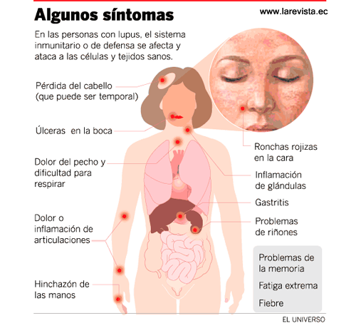 emilio_delrio's tweet photo. El lupus es una enfermedad autoinmune, es latín,LUPUS,"lobo"
En lat. no se aplica a enfermedad, pero sí en lat. medieval donde significa "enfermedad erosiva de la piel", la idea etimológica es "que come" En español en el XV era variedad de "cáncer"

Hoy es el #DiaMundialDelLupus https://t.co/1bLnViFTdJ