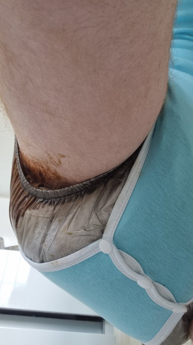 curiousdluk's tweet photo. Had a bit of a leak 😳 fortunately my plastic pants kept it mostly contained 😅🙈 https://t.co/L3yzbuJQ4a