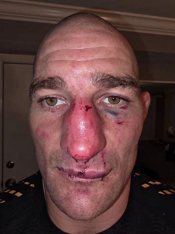 UFC | سالم tweet media