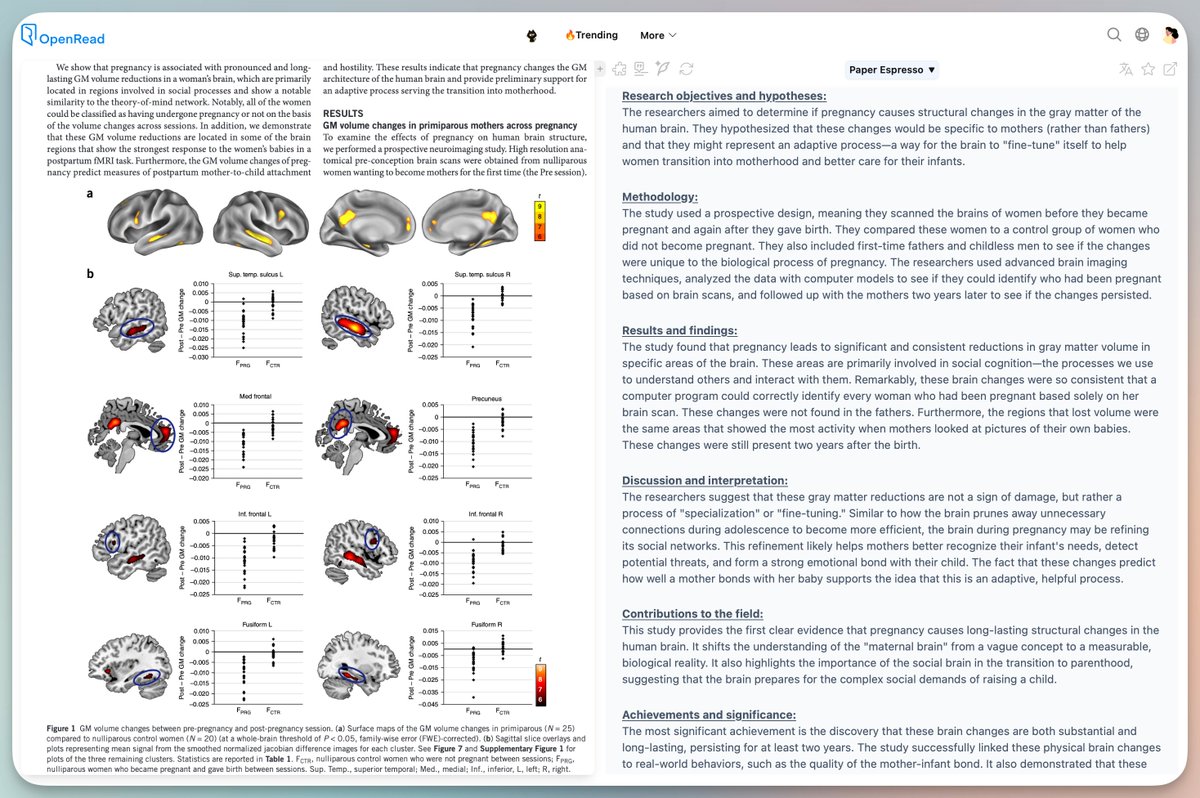 zoewangai's tweet photo. @NTFabiano This study found that pregnancy leads to significant and consistent reductions in gray matter volume in specific areas of the brain. These areas are primarily involved in social cognition—the processes we use to understand others and interact with them.
https://t.co/IMaOYOBzJT https://t.co/xXIyNDKeRX