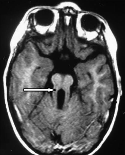 docakx's tweet photo. A tooth was found in a child's MRI scan. 

Which syndrome? https://t.co/H7BxoKfzci