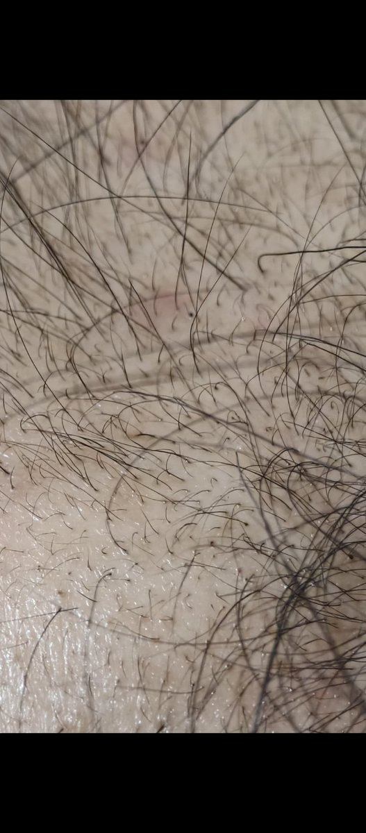 Case Regrowth tweet media