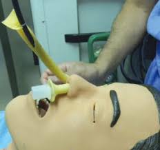 NaveenEipe's tweet photo. @AirwayMxAcademy @jducanto @TBayEDguy @SafeAirway @dasresidents "Puncture Grape"- probably don't!
"Expel by Cough"- maybe not!!

Maybe TIVA &amp; Spont Resp thru ModNT, VAFI to secure Grape with a Magill, and rescue eFONA? 

But the age and the airway edema.......#ToughCase https://t.co/35xFrKuMWm