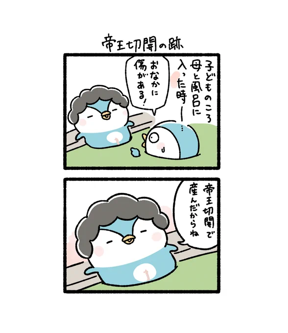 帝王切開の跡(1/2) 