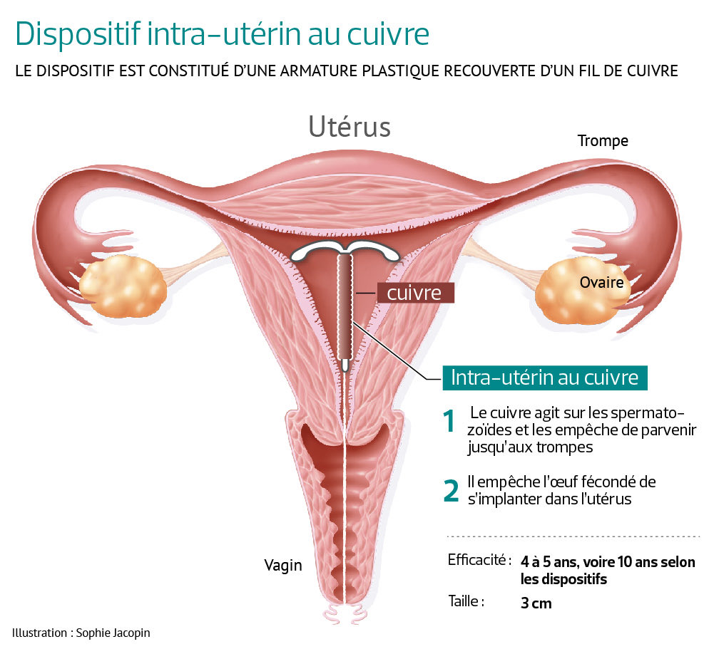Akanefujoshi's tweet photo. @GossipRoomOff Au cas où ceux qui veulent contester la douleur que ressentent les femmes, un stérilet se pose dans l’utérus en passant par le col donnant ayant des douleurs comparables à des contractions pour certaines 
Ouvrez google c’est gratuit https://t.co/SMmZhHSuYN