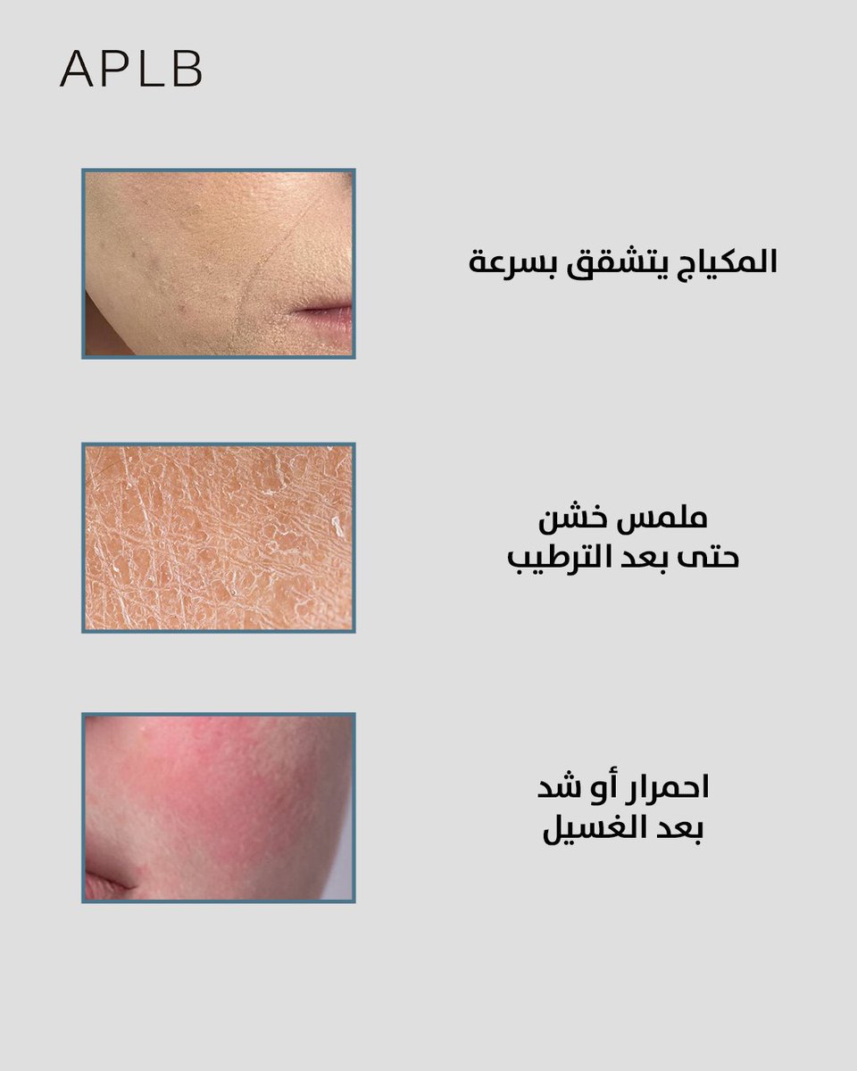dovacare's tweet photo. مكياجك يتشقق و بشرتك خشنة رغم الترطيب..
يعني حاجز بشرتك يحتاج دعم بشرتك ما تبي ترطيب سطحي، تبي  ترطيب عميق.
الحل مع APLB Urea Hyaluronic Acid:
🔹 هيالورونيك: يروي البشرة ويرطب بعمق  ويعطيها امتلاء .
🔹 يوريا:تقوى حاجز البشرة وتحسن ملمسها.
ودّعي الجفاف للأبد، وجربي قوة APLB الآن https://t.co/m1ziU0PDjJ