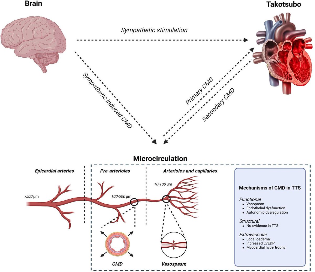 Heart_BMJ's tweet photo. Role of coronary microvascular dysfunction in takotsubo syndrome https://t.co/vRBHE1Xrwd https://t.co/zodGCln6Qx