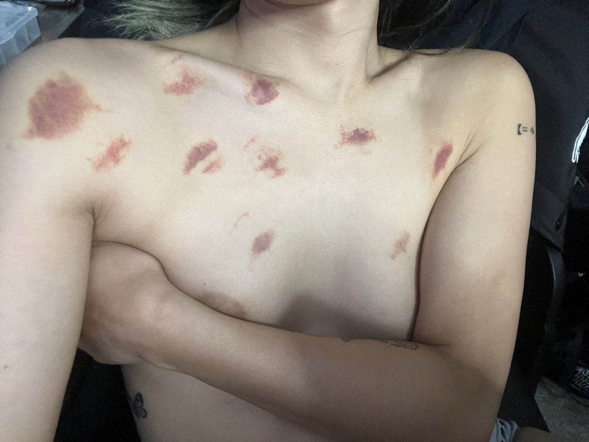 ViVioletCobalt's tweet photo. I need more marks. Anyone want to leave theirs? 👉🏼👈🏼 https://t.co/yx61ft3Z6y
