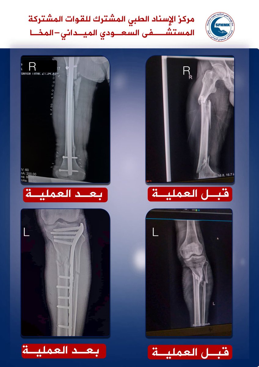 دائرة الخدمات الطبية ( المقاومة الوطنية ) tweet media