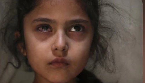 kashmiri_diary's tweet image. 2 Kashmiri children became victims of pellet gun violence in IIOJK , an 11year old girl lost her left eye after being shot with pellets,  Other 6year old Muneefa  was shot in her right eye with pellet gun , a weapon  used for hunting animals.
#łatwogang #Mérida #kashmir