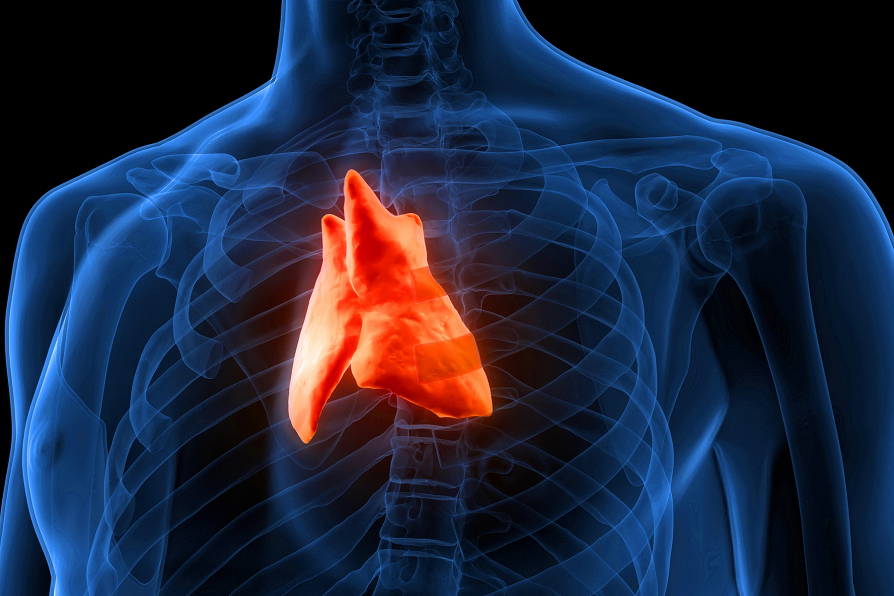 Jacobs_Med_UB's tweet image. In a @Jacobs_Med_UB @JamaNetworkOpen paper, the surgical removal of the thymus added “quality adjusted life years” to patients and was also cost-effective compared to pharmacological treatment alone in myasthenia gravis patients.

Read more🗞️ms.spr.ly/6013vHMed

#UBuffalo