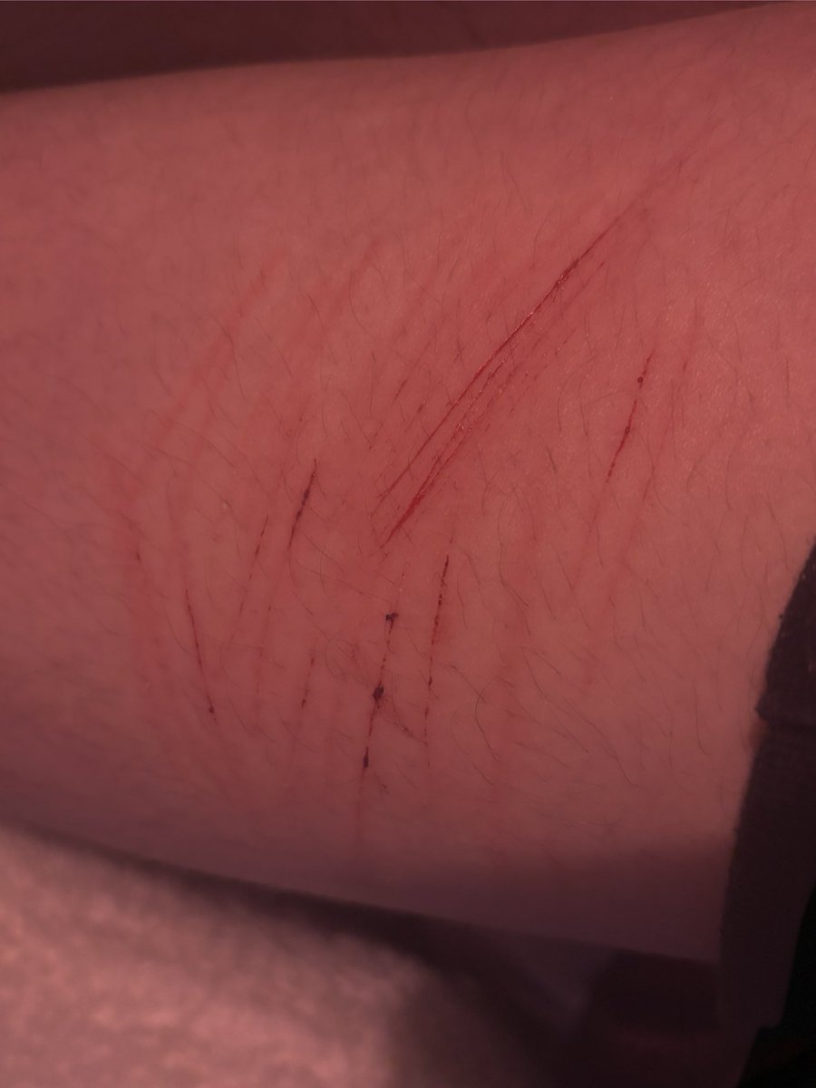 Rave 🪶🍃 shedtwt tweet media