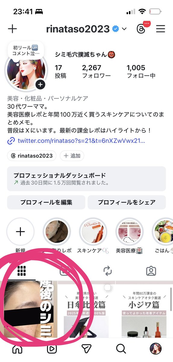 シミ毛穴撲滅ちゃん👹 tweet media