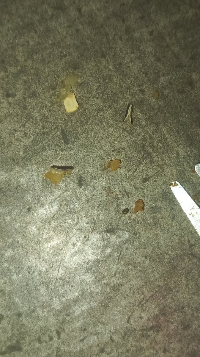 Alfansebhau's tweet image. सावधान! @amazon से Nutrela Soya Chunks खरीदे, जिनमें कीड़े और कचरा निकला है। उबालने पर भी गंदी बदबू आ रही है। हेल्थ के साथ बड़ा खिलवाड़!
मेरी सलाह है कि कोई भी इसे न खरीदे। अपनी सेहत का ध्यान रखें। 🚫🤢

@Nutrela_India @fssaiindia #ConsumerAwareness #HealthHazard #FoodSafety