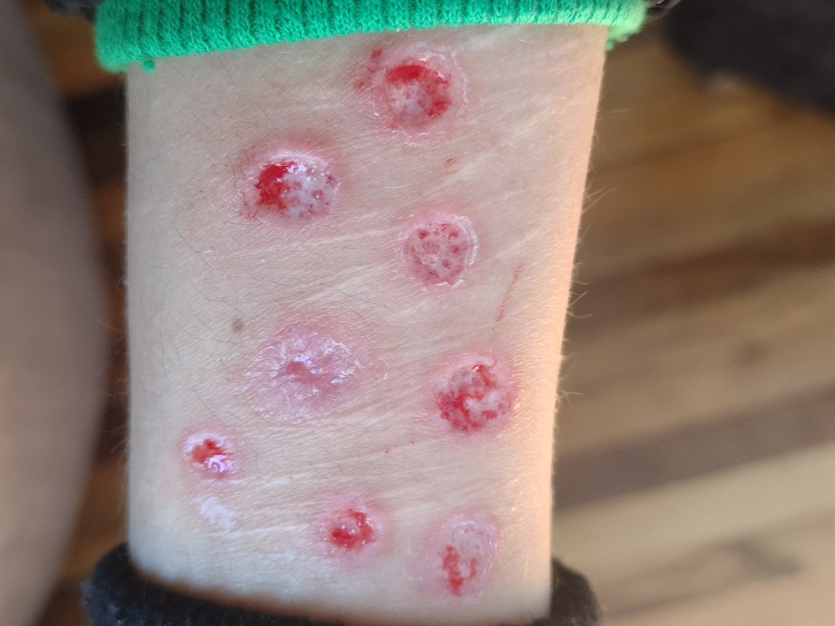 tini (TW) he/him tweet media