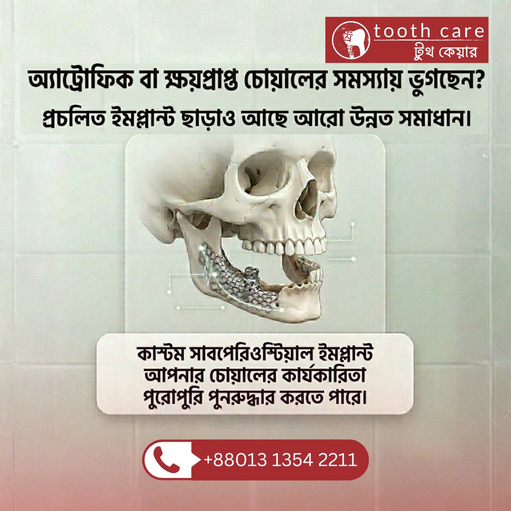 ToothCarebd's tweet image. চোয়ালের হাড়ের ক্ষয় এখন আর সমস্যা নয়! 🦷

হাড়ের তীব্র ক্ষয়ের কারণে যাদের সাধারণ ইমপ্ল্যান্ট সম্ভব নয়, তাদের জন্য রয়েছে কাস্টম সাবপেরিওস্টিয়াল ইমপ্ল্যান্ট। এটি আপনার চোয়ালের কার্যকারিতা পুরোপুরি পুনরুদ্ধার করতে পারে।

বিস্তারিত জানতে কল করুন: +88013 1354 2211

#OralCare