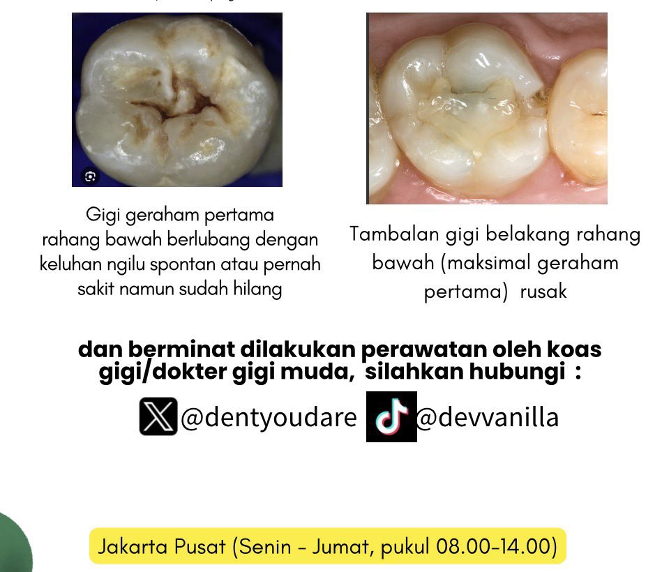 dentyoudare's tweet photo. @flllowiee pengen kerja pasiennnn yuk yg punya keluhann kayak di foto boelh dm yaa https://t.co/ZSc5pnJnD4