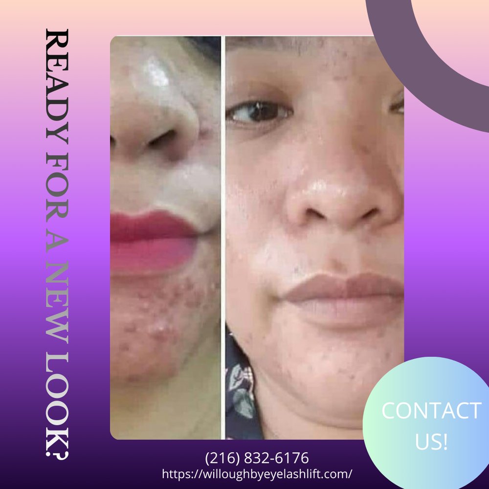 raquelbeauty_'s tweet image. I provide facials that combine gentle techniques with effective products to support glowing skin. Each visit is designed to feel calm and restorative. Schedule your session today and enjoy visible results.
#Facials
willoughbyeyelashlift.com/contact