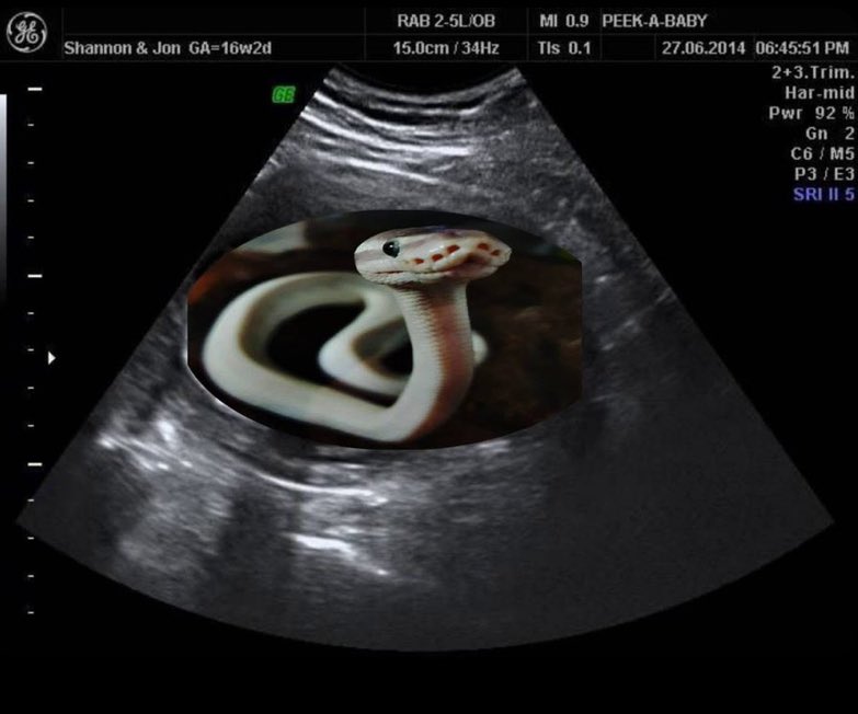 ꌦꋬ꒯ꄲꅐ🕊️ tweet media