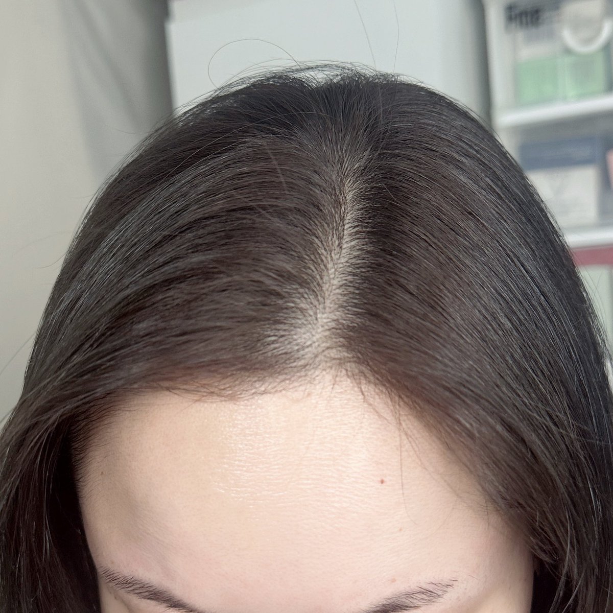 กดมาแล้วค้าบบ CLEAR ออกไลน์ใหม่ ขจัดรังแค Dandruff Rescue มีแชมพูกับเซรั่ม เราผมยาว บางทีก็รู้สึกว่าตัวเองมีรังแค ไม่มั่นใจเลย แต่พอได้ลองเคลียร์สูตรนี้แล้วว้าวมาก คือรังแคลดลงเลย ตอนหวีผม สางผมก็มั่นใจขึ้นมากก เราใช้คู่กันเลยนะ ทั้งแชมพู ทั้งเซรั่ม เริ่ดจริง #ClearThailand