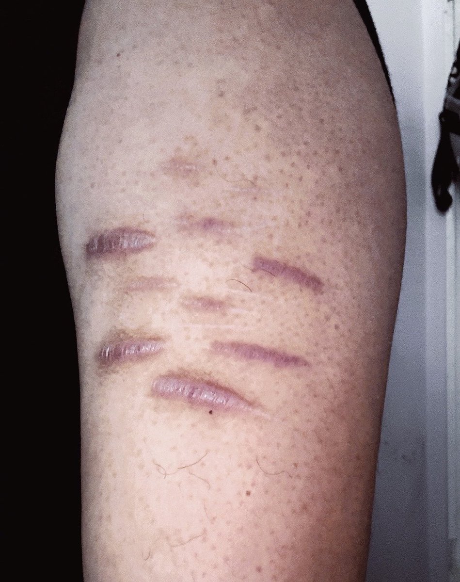 ♡ amanda gaddis of shtwt tweet media