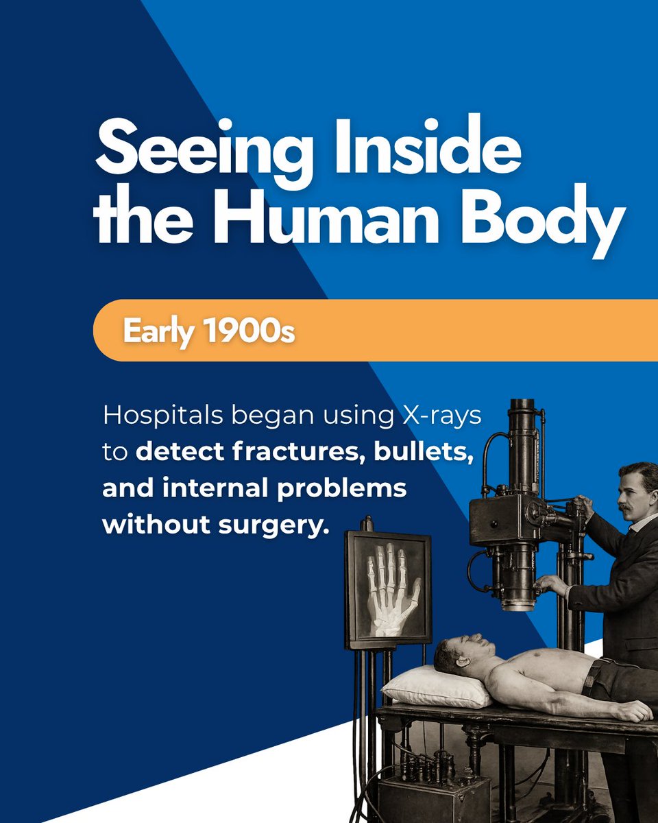 MedDeviceDepot's tweet photo. Did you know the first X-ray image was of a hand wearing a ring?

From 1895 to today’s AI-powered imaging, X-rays transformed how we detect injuries &amp; disease—no surgery needed.

#XRay #Radiology #MedicalInnovation #HealthcareTechnology https://t.co/Oqb2PAD8VK