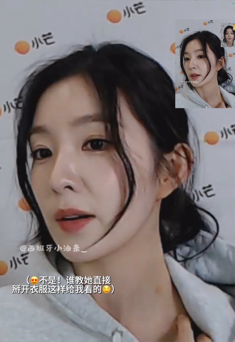 zqwbae's tweet image. irene showed her neck to op about the bruise☺️
#IRENE #아이린 #alpharene