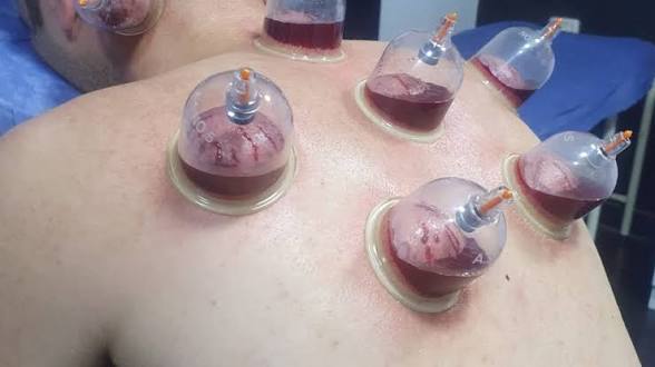 د. محمد سعيد طب بديل tweet media